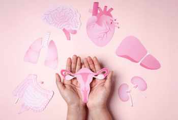 PCOS