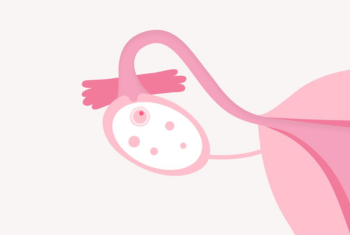 low ovarian reserve