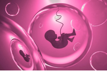 IVF